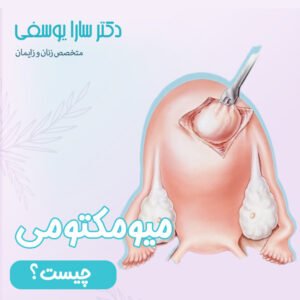 میومکتومی - دکتر یوسفی