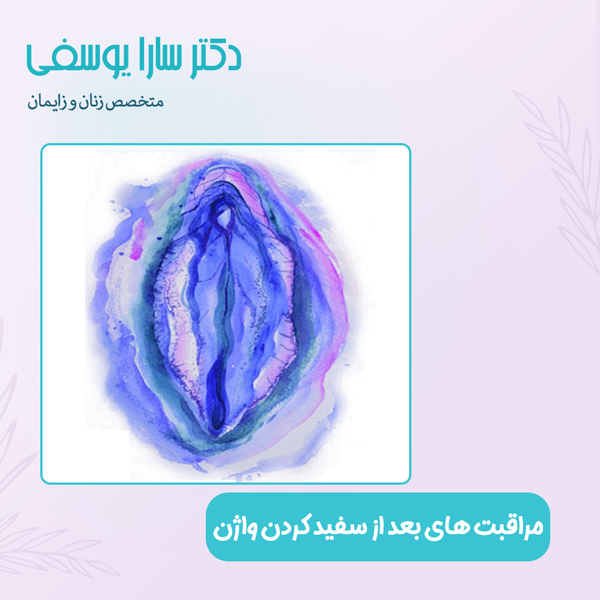 مراقبت های بعد از سفید کردن واژن - دکتر سارا یوسفی