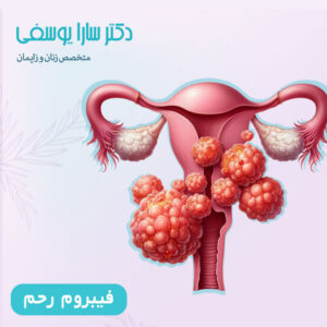 فیبروم رحم - دکتر سارا یوسفی