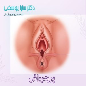 پرینورافی https://drsarayousefi.com/