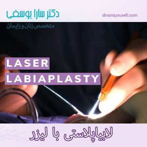 عمل لابیاپلاستی با لیزر