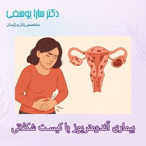 بیماری آندومتریوز