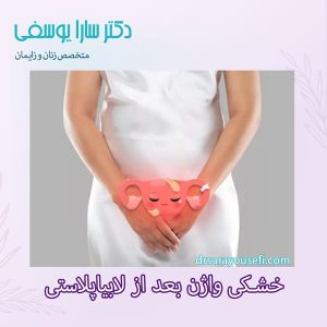خشکی واژن بعد از لابیاپلاستی - دکتر سارا یوسفی