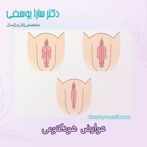 عوارض هودکتومی _ دکتر سارا یوسفی