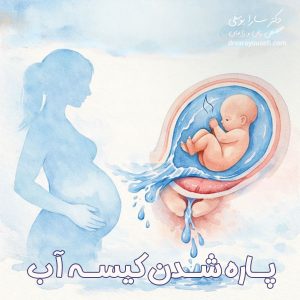 پاره شدن کیسه آب + دکتر سارا یوسفی